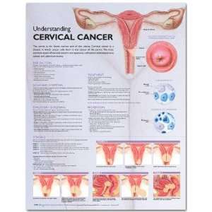  Understanding Cervical Cancer Anatomical Chart Industrial 
