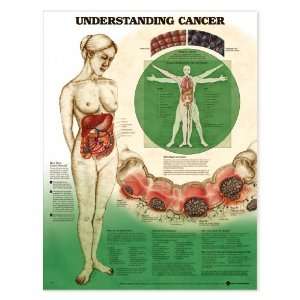  Understanding Cancer Anatomical Chart Laminated 9756PL1.5 