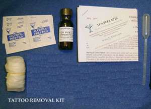 TCA Tattoo Removal Kit with PERFECT Concentration of ACID. 18 Month 