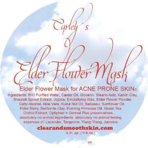  Carleys Elder Flower Mask for Acne Prone Skin: Beauty